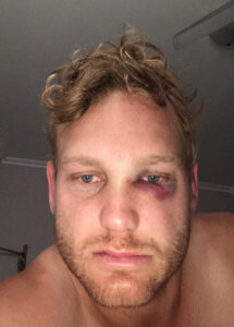 Sunraysia cricket: Workers Gol Gol all-rounder Nick Jensen sidelined