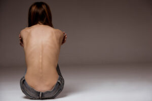 Plan to cut cost of eating disorders