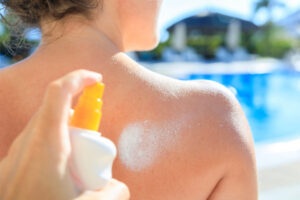 Melanoma prevention the best thing under the sun