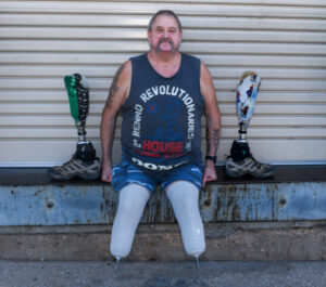 Amputee support group thriving