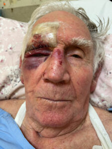 War vet ‘shocked’ by indifference