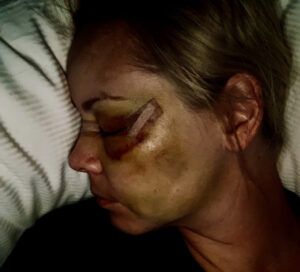 Kim O’Reilly ‘devastated’ by attacker’s release