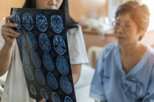 Stroke warning over Mallee cholesterol
