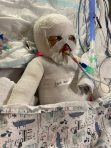 Community rallies for brave Elijah