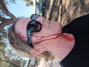 Ouch! Swooping magpie strikes Mildura walker